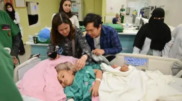 صحيفة المرصد – “الربيعة” يوضح تفاصيل عملية فصل التوأم الملتصق الفلبيني “كليا وموريس آن”.. ويُحدد نسبة الخطر!