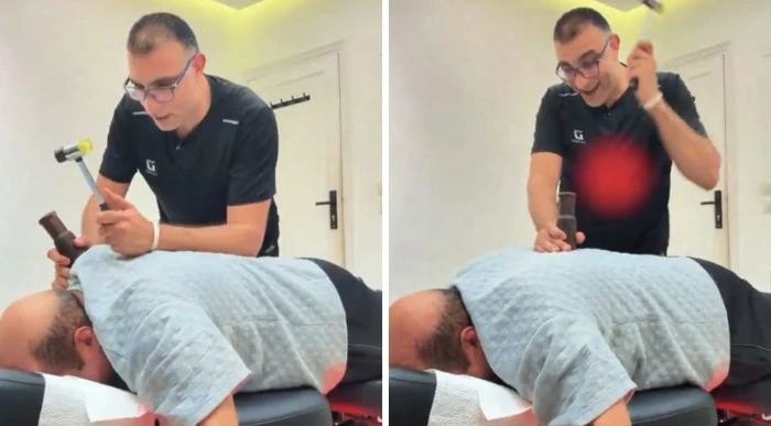 صحيفة المرصد – “يا شيخ مريع ليش تصوت فضحتنا بين القبايل”.. فيديو طريف للطبيب المصري أبو النصر يعالج مريضاً سعودياً باستخدام المطرقة والأخير يصرخ من الألم